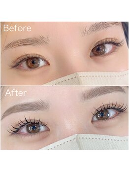 トリート 芦屋店(treat)/エクパーマ　LEDマツエク