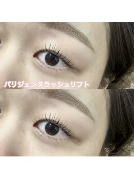 レディエント(Radiant)/パリジェンヌラッシュリフト