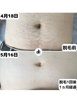 ビューティーサロン マル(Beauty Salon MARU)/