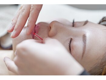 ハリノヒ 本町院/美容鍼でくすみ・たるみ改善事例