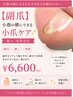 【副爪】小指の横の小爪ケア♪痛み・角質改善￥6600/1箇所