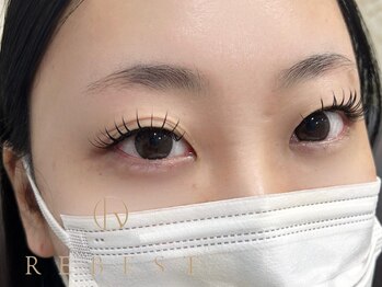 リーベスト 心斎橋(REBEST)/バイントロック