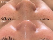 リボーン 浜松(reborn)/