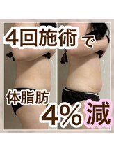 ミュウ(miuex)/1ヶ月で体脂肪4%減！