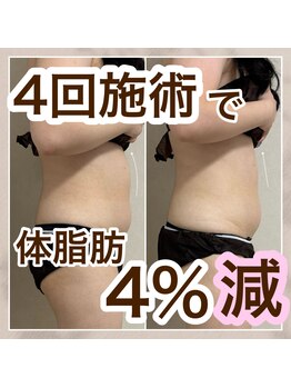 ミュウ(miuex)/1ヶ月で体脂肪4%減！