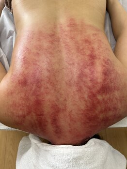 サロン ド アヤ(salon de Aya)/経絡カッサ