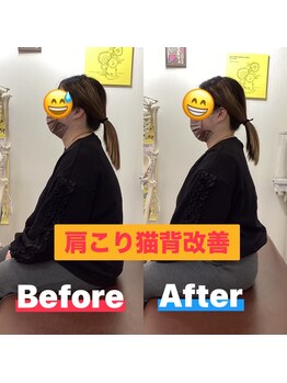 ヒデ整体院(Hide整体院)/猫背矯正骨盤矯正B/A肩こり腰痛
