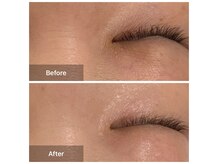 京都では稀な最高峰ACマシン導入！直後からの変化の感動体験を！