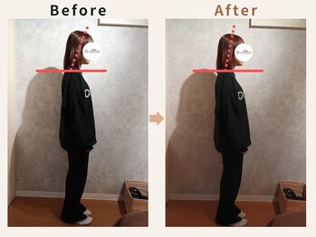 ハリデイズ/30代-姿勢改善