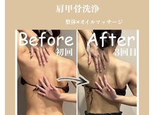 モモリラ(momorila)の雰囲気（肩甲骨剥がしに特化【肩甲骨洗浄】辛い肩こりやブライダル前に◎）