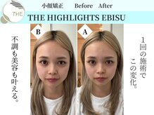 ザ ハイライト 恵比寿の雰囲気（顔のむくみ、歪み、左右差、リフトアップもお任せください☆）