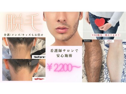 ダイア(DIA)の写真