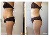【痩身/ダイエット3パーツ】組み合わせ自由に痩せたいご希望の部位80分