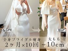 スリムプロ 天王寺店(Slimpro)の雰囲気（最新マシンハイパーナイフで短期集中！ワンランク上のボディに☆）