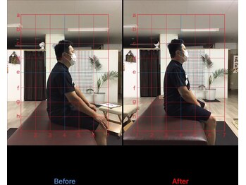 ストレチックス 近江八幡店/before/after