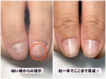 ココネイル(coco.nail)/コンプレックス爪を美爪にします