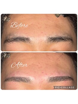 マイサロン(MY SALON)/自己処理失敗カバーカット！