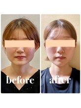 クリーム 京都店(Cream)/アゴの形を変える希少なエステ