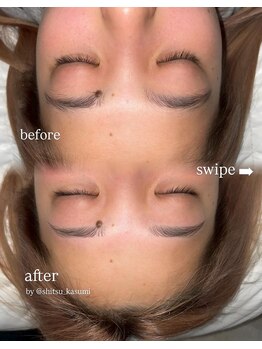 シツ(SHITSU)/症例【before・after】眉毛Wax