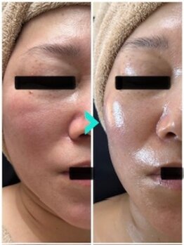 ミルキー(Milky)/え？マッサージしてないの？？