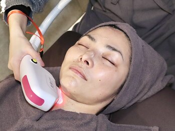 ヨモギスト(yomogyst)の写真/【シミ/シワ/ホウレイ線/たるみ改善◎】切らないリフトアップ★ハリツヤ美肌へ♪光糸リフト¥12500→¥6250