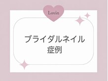 ラヴィン 生駒店(Lovin)/ブライダルネイル症例