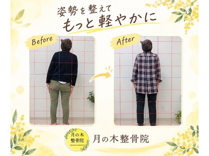 月の木整骨院の写真