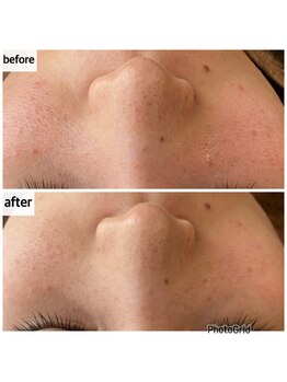 メナードフェイシャルサロン 岐阜茜部/クリーンパック◎