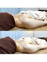 コモド(COMODO)/バストアップbefore&after