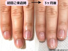 カピリナ(Ka Pilina)/自爪育成・川崎