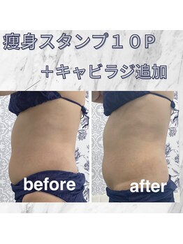 ハロ 南青山(HALO)/痩身スタンプ10P+キャビラジ