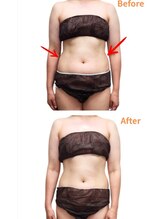 ヴィセル(VISEL)/痩身強圧リンパマッサージ