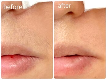 メイクマジック(Makemagic)/毎日剃るより月1ワックス