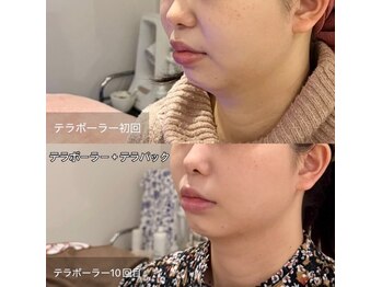 アオダモ(aodamo)/