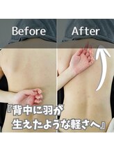鍼灸整体院ユー(鍼灸整体院You...)/肩甲骨はがし
