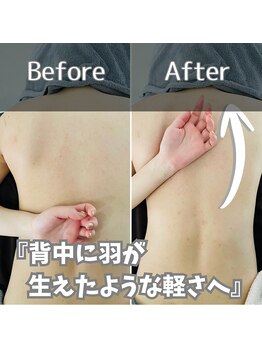 鍼灸整体院ユー(鍼灸整体院You...)/肩甲骨はがし