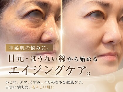 ルフレ(REFLET)の写真