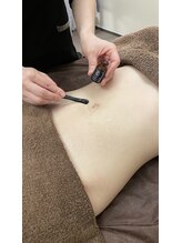 ブルームエイト(Bloom8)/針の要らない脂肪分解