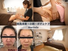 メリンダ(Merinda)