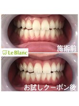 ルブラン 奈良店(Le Blanc)/男性の方も気軽に(^ ^)