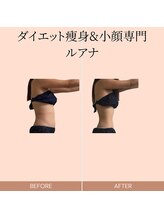 ルアナ(Luana.)/ダイエット痩身
