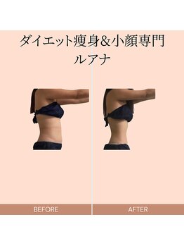 ルアナ(Luana.)/ダイエット痩身