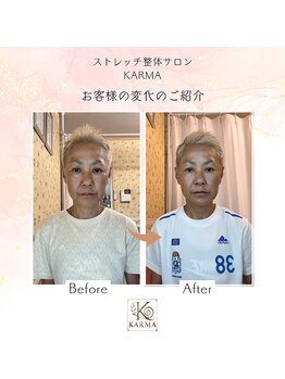 カルマ(KARMA)/MENU【トータル美顔ケア】