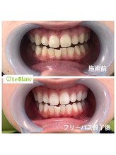 ルブラン 奈良店(Le Blanc)/お得なキャンペーン中！