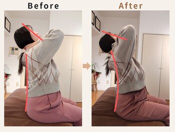 ハリデイズ/20代-肩こり首こり/姿勢改善