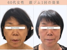 那賀洋子式 顔ジム 大分戸次店/60代女性顔ジム1回の効果