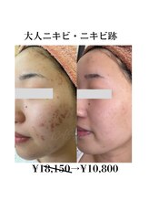 アルルプラス 山科(ARuru+)/before after