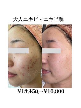 アルルプラス 山科(ARuru+)/before after