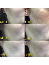 エトル(etole)/30代お客様症例写真