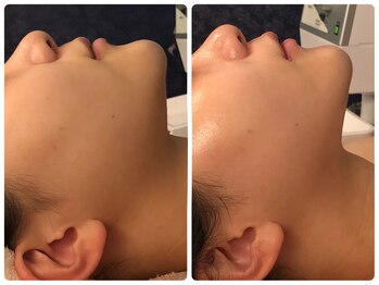 サロンドプレマージュ(Salon de Premage)/ラフォスフェイシャル